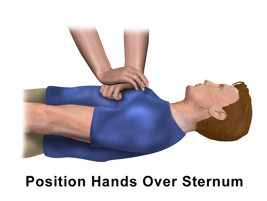 CPR